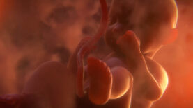 Medizintechnik Knochen